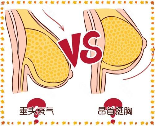 女生怎么擠胸？ 擠壓乳房有什么危害？