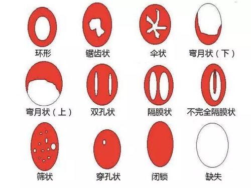 如何解決第一次破處出血？