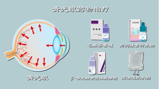 青光眼激光治療副作用_青光眼激光治療副作用大不大