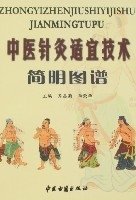 中醫(yī)針灸適宜技術(shù)簡明圖譜