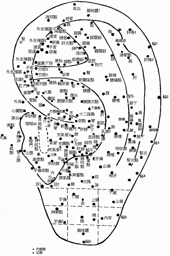 耳穴圖