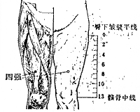 四強穴