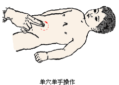 瀉法