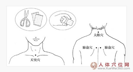 巧用膏藥敷穴位，止咳平喘見效快